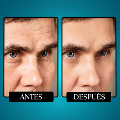 MORGE SKIN | Borra las Arrugas y Ojeras en 3 Semanas.
